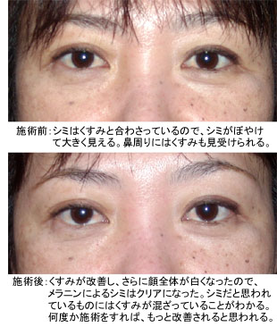 �N���b�N����Ƒ傫�ȉ摜